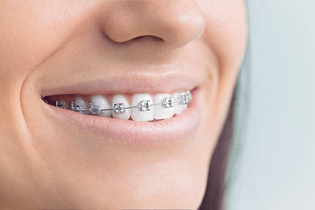 Laser Dentistry in Rancho Viejo, TX